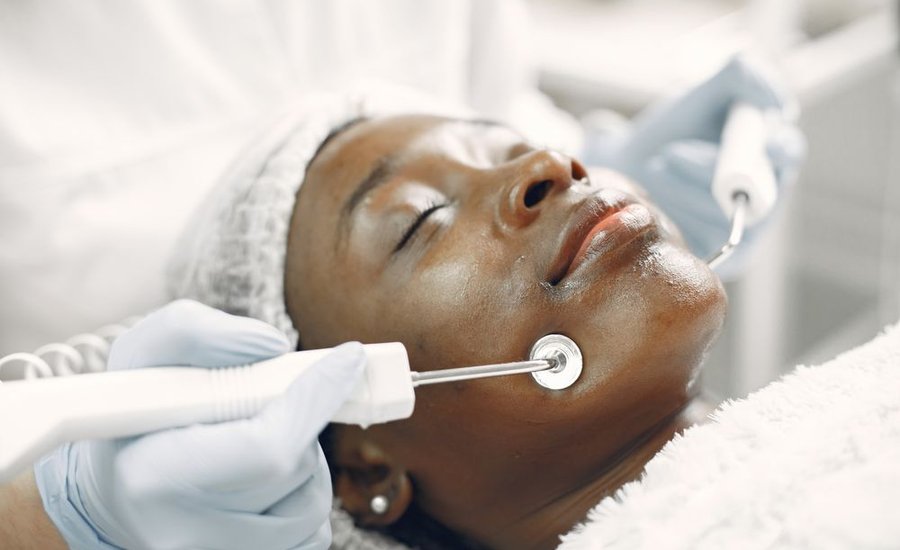 Imagem ilustrativa de Peeling LHA