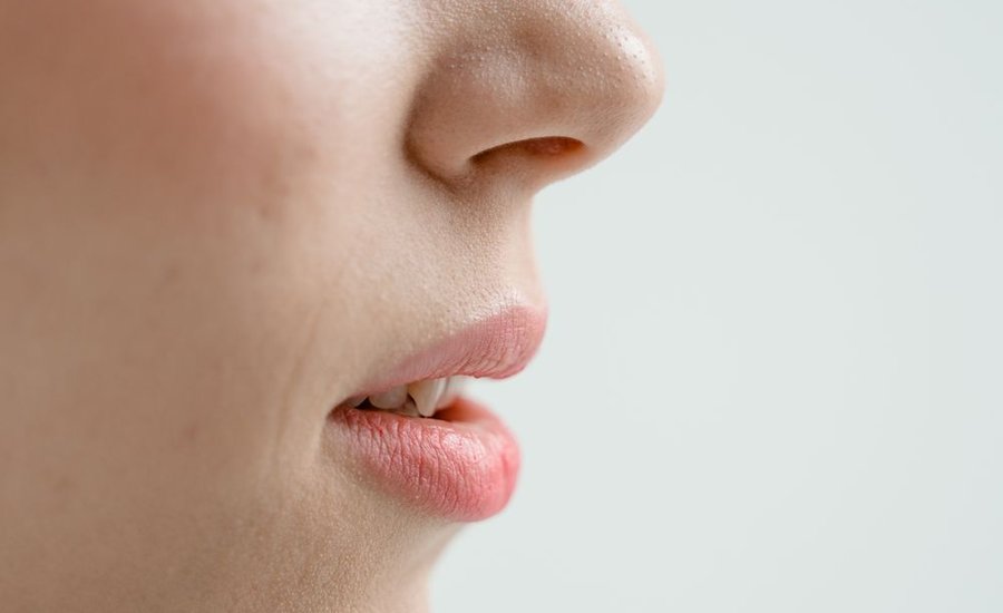 Imagem ilustrativa de Perfiloplastia